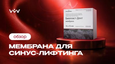 Биопласт-Дент мембрана — Синус-лифтинг с помощью мембраны | Обзор.